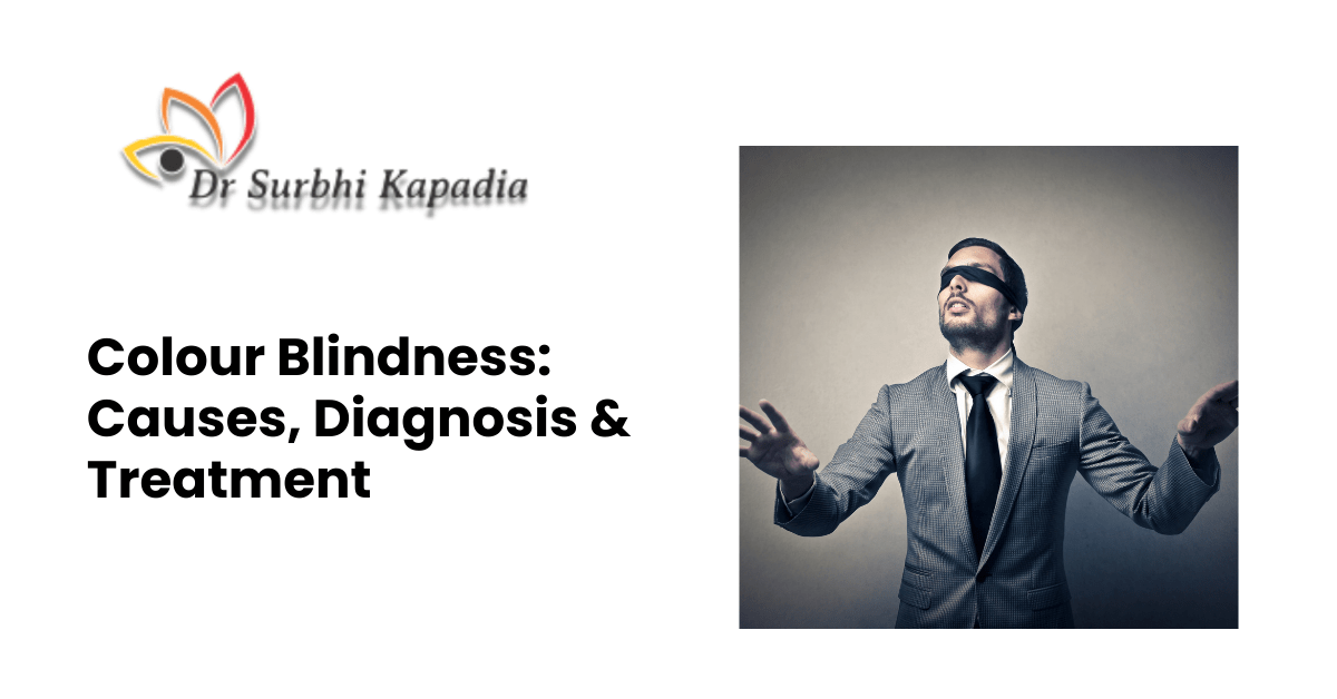 Colour Blindness Causes, Diagnosis & Treatment Dr. Surbhi Kapadia